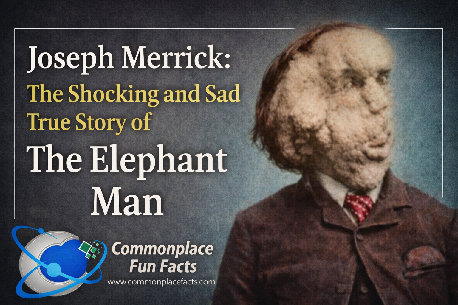 Joseph Merrick: The Shocking and Sad True Story of The Elephant Man